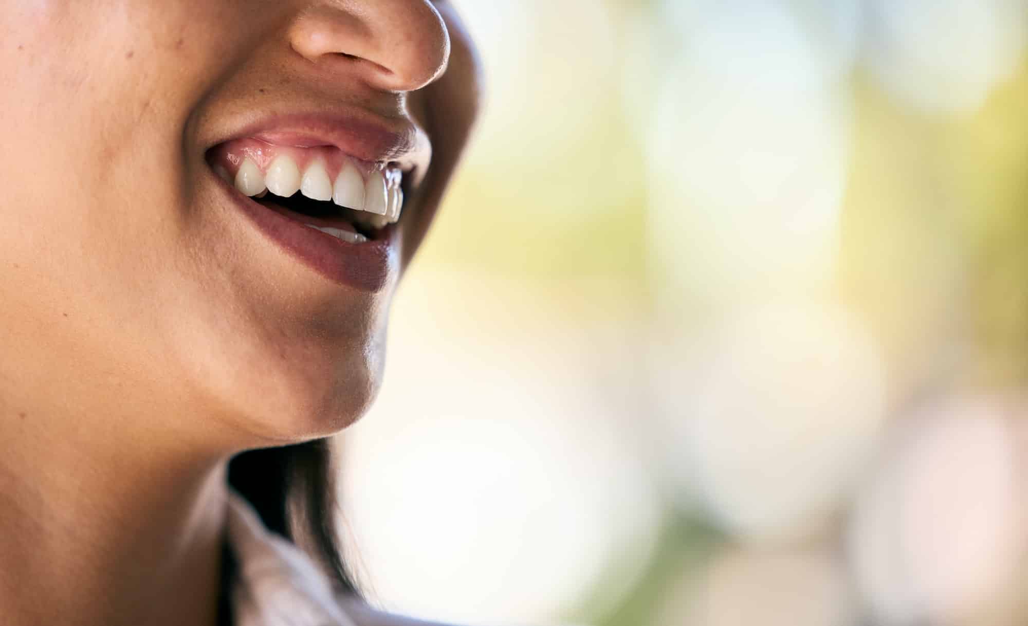 Dental, teeth or mouth with a smile in nature laughing after a successful teeth whitening at dentis